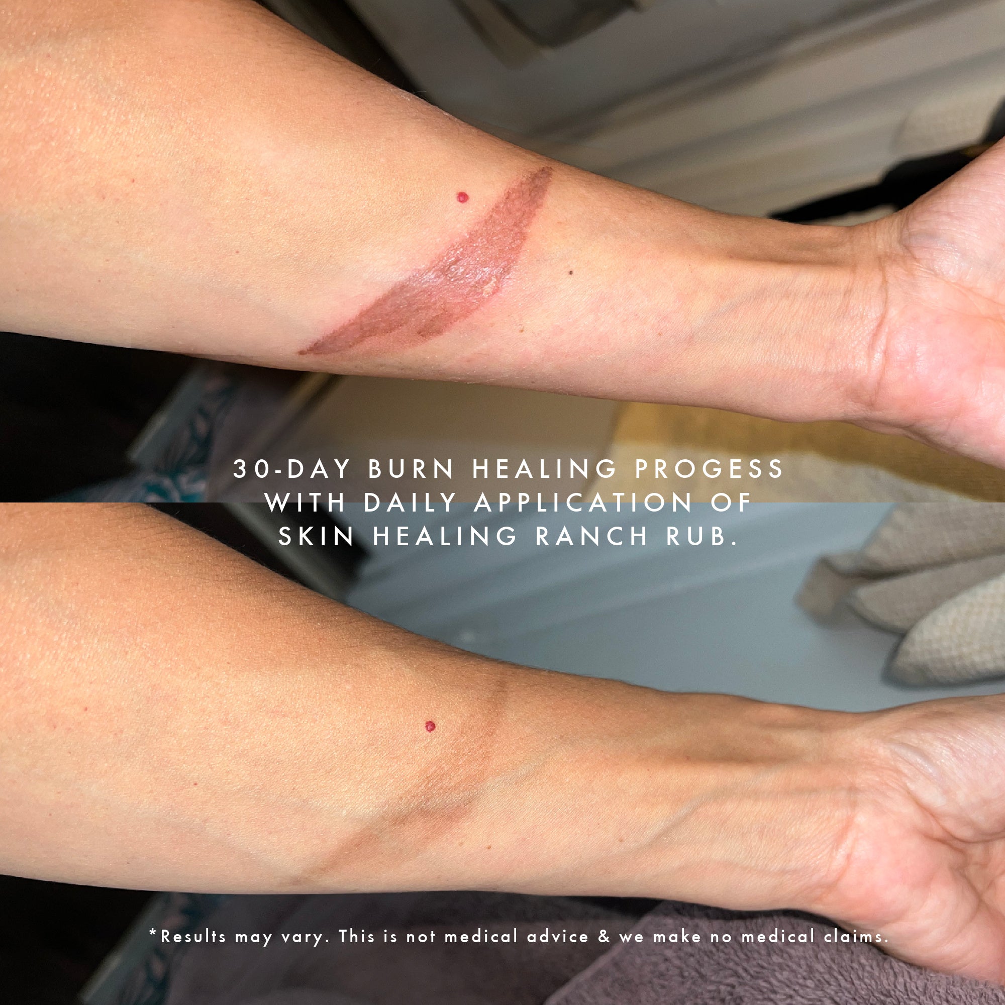 RANCH RUB - SKIN HEALING TALLOW SALVE WITH BLUE TANSEY, COMFREY & TEA TREE